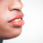“ศัลยกรรมปากห้อย” กับหมอภู หมอชื่อดังเกี่ยวกับการแก้ไขปาก!!! จาก  Punisa Clinic